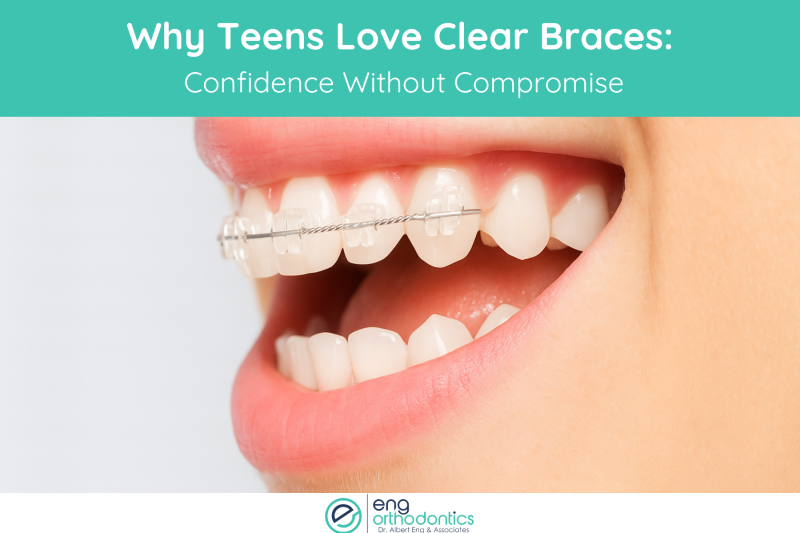 Why Teens Love Clear Braces Confidence Without Compromise